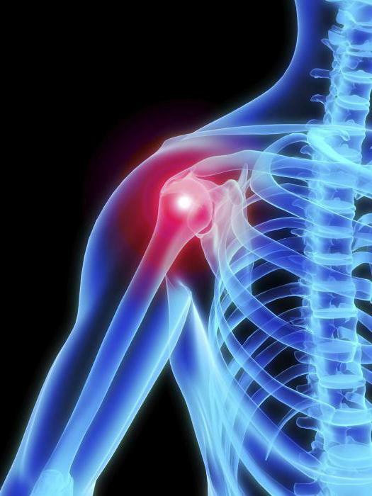 arthrosis of the shoulder joint symptoms and treatment