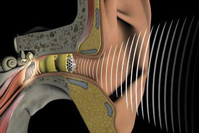 intrakanāla dzirdes aparāta atsauksmes